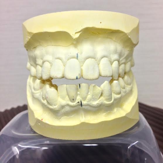 なぜ口（歯）の不調和が全身に影響するのか？　-システム編-